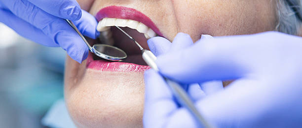 Best Emergency Dental Care for Broken or Chipped Teeth in Georgetown, IN